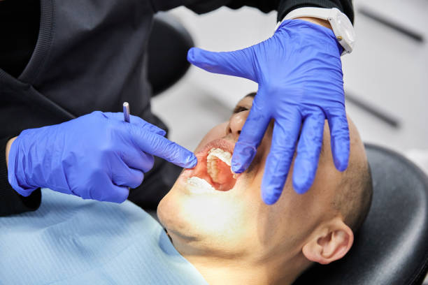 Best Emergency Cosmetic Dentistry (e.g., broken veneers) in Oconto Falls, WI